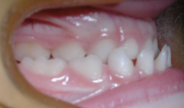 maloclusion dental ortodent