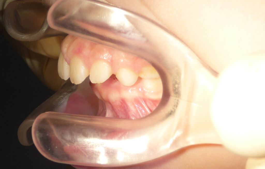 caso ortopedia dental
