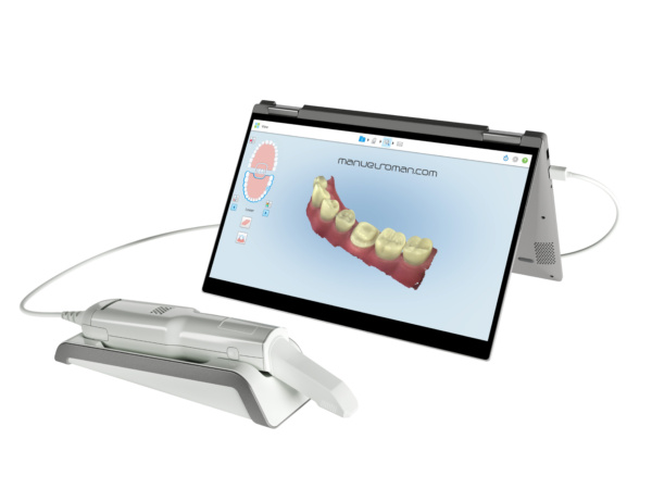 scanner itero invisalign en Tenerife