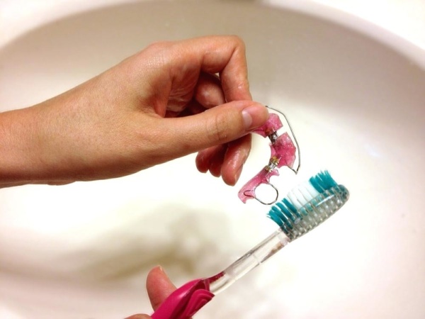 limpiar férulas dentales